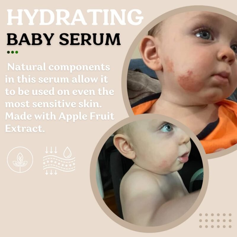 Baby Care, Baby Skin Care Baby, Children Power Serum