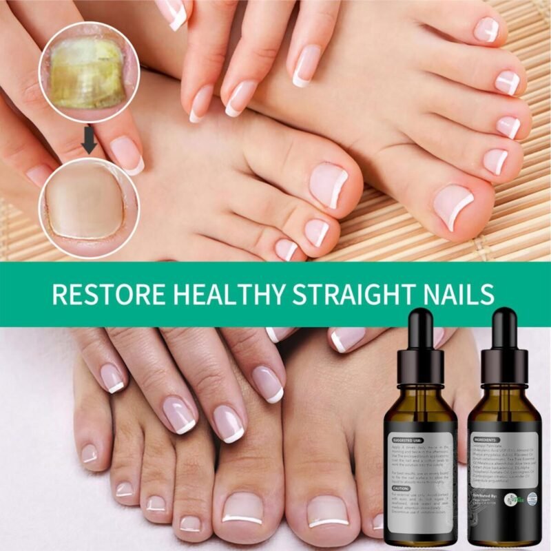 Nail Care, Nail Treatment, Metanail Toenail Treatment Serum