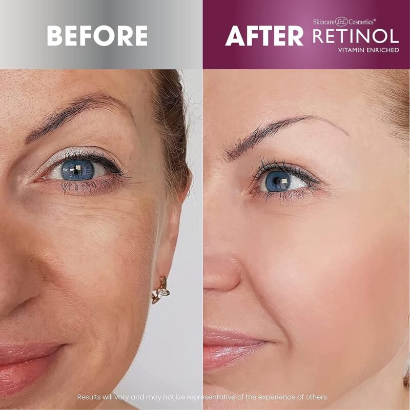 Skin Care, Cosmetics , Personal Care, Beauty, Anti-Aging Eye Gel